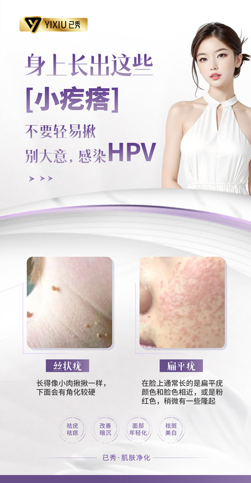 已秀减肥店都有哪些