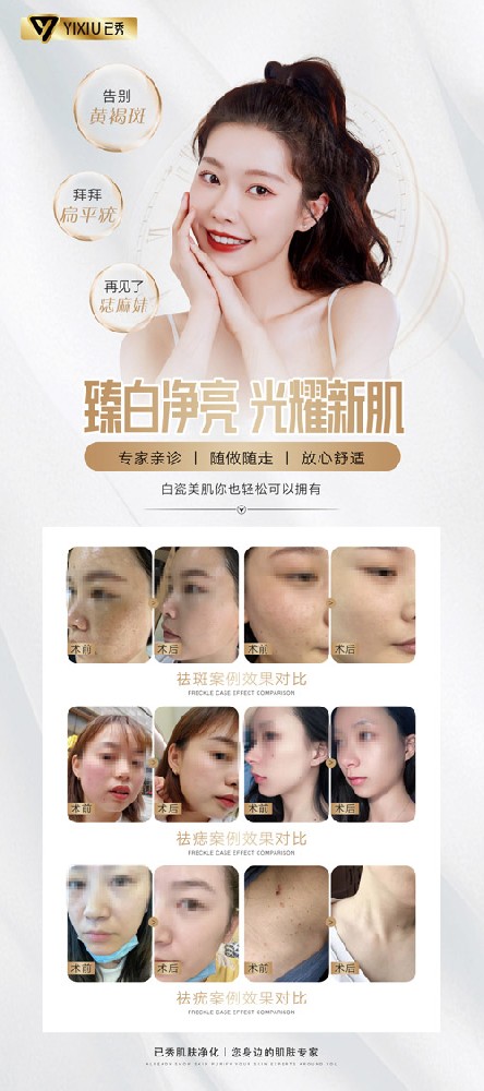已秀减肥店效果